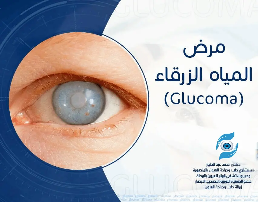 علاج المياه الزرقاء